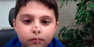 Child undergoing vision disorder assessment with specialized testing equipment